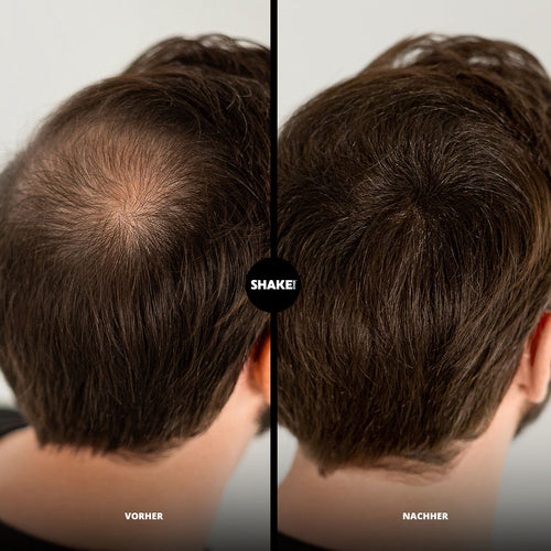 Fibres Capillaires SHAKE OVER Enrichies En Zinc